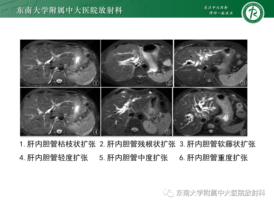 影像PPT - 【PPT】恶性胆道梗阻疾病影像诊断思路-9