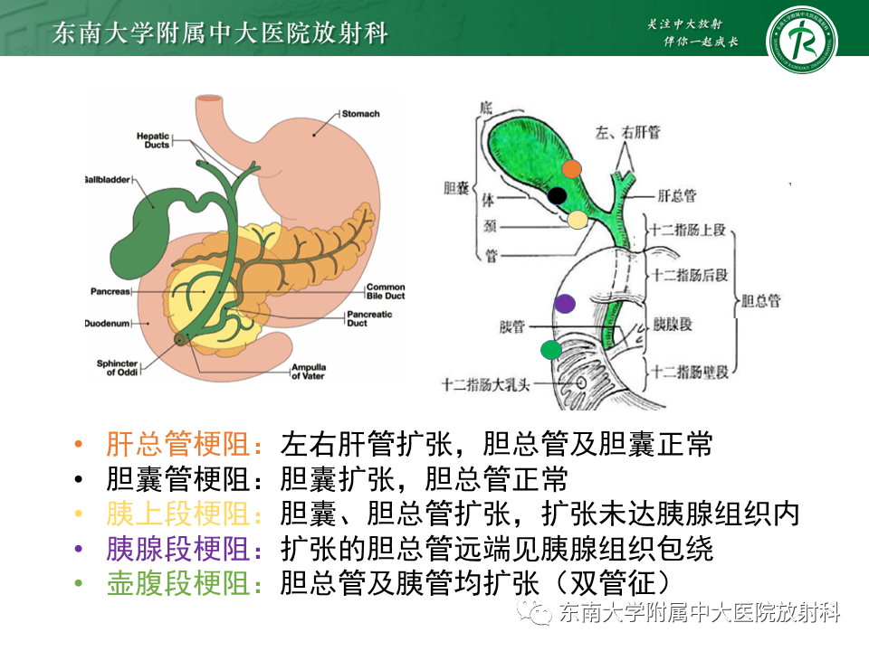 影像PPT - 【PPT】恶性胆道梗阻疾病影像诊断思路-11