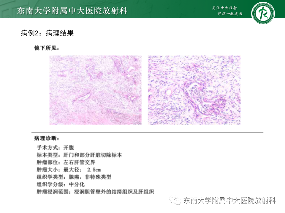 影像PPT - 【PPT】恶性胆道梗阻疾病影像诊断思路-14