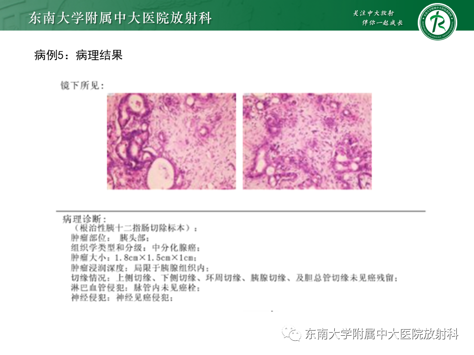 影像PPT - 【PPT】恶性胆道梗阻疾病影像诊断思路-25
