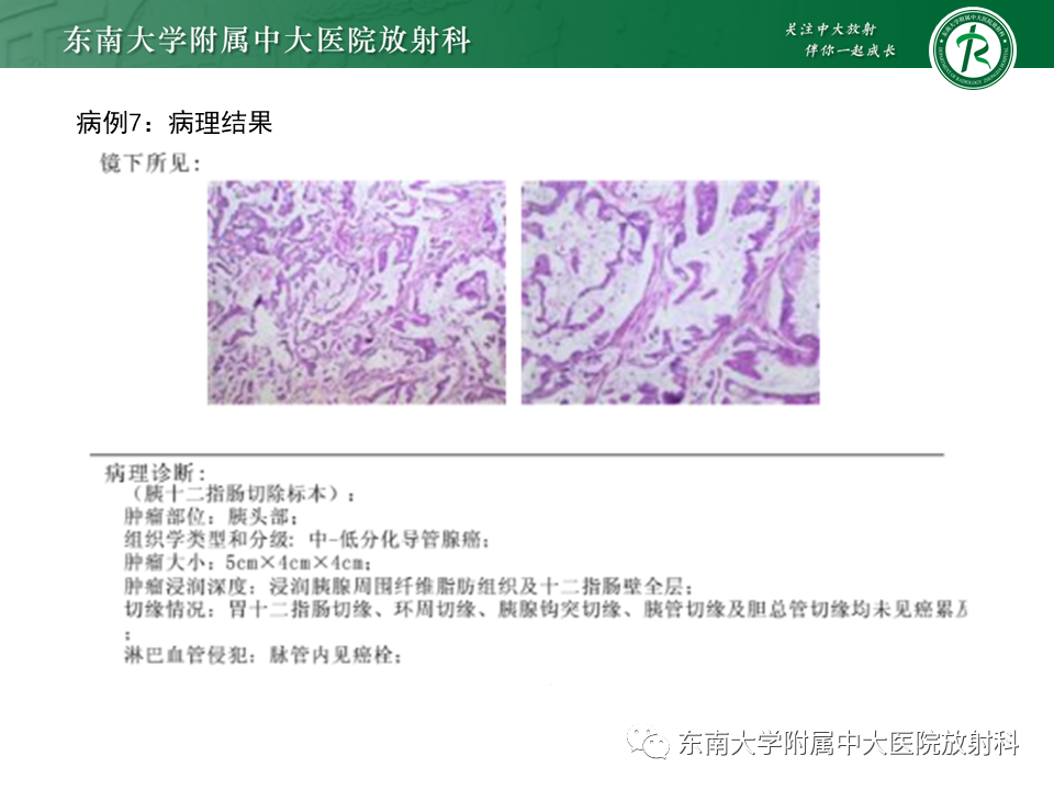 影像PPT - 【PPT】恶性胆道梗阻疾病影像诊断思路-29