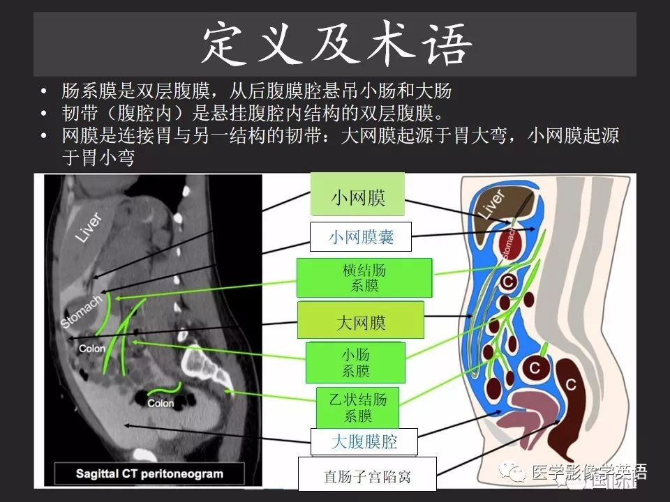 影像PPT - 【PPT】腹腔游离气体:从哪里来?如何应用腹膜解剖确定穿孔部位-5 影像PPT - 【PPT】腹腔游离气体:从哪里来?如何应用腹膜解剖确定穿孔部位-5