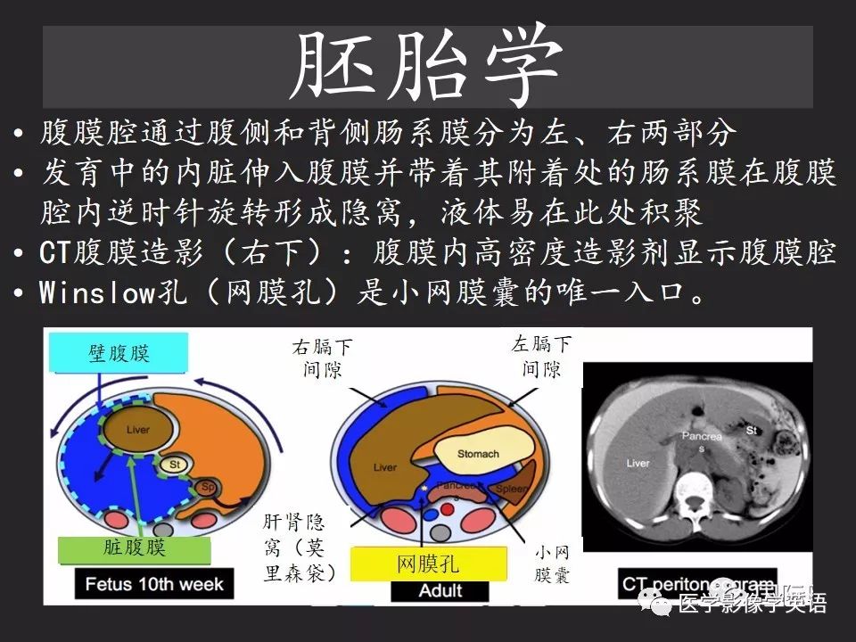影像PPT - 【PPT】腹腔游离气体:从哪里来?如何应用腹膜解剖确定穿孔部位-8 影像PPT - 【PPT】腹腔游离气体:从哪里来?如何应用腹膜解剖确定穿孔部位-8