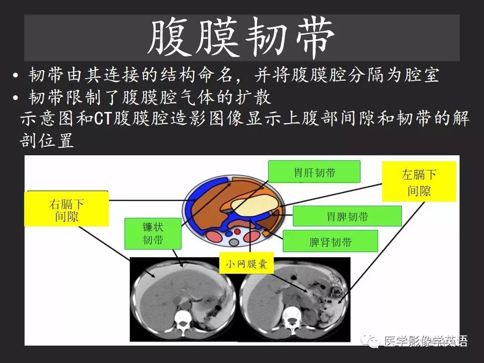 影像PPT - 【PPT】腹腔游离气体:从哪里来?如何应用腹膜解剖确定穿孔部位-9 影像PPT - 【PPT】腹腔游离气体:从哪里来?如何应用腹膜解剖确定穿孔部位-9