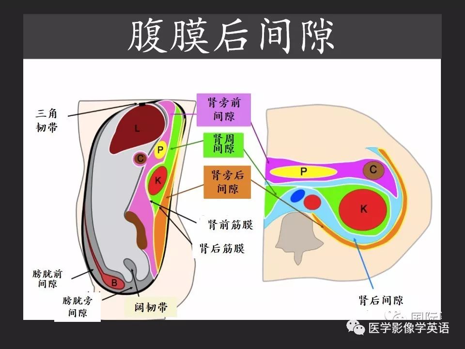 影像PPT - 【PPT】腹腔游离气体:从哪里来?如何应用腹膜解剖确定穿孔部位-26 影像PPT - 【PPT】腹腔游离气体:从哪里来?如何应用腹膜解剖确定穿孔部位-26