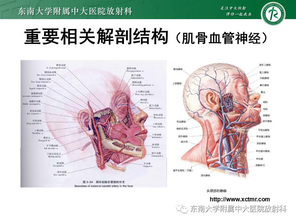 影像PPT - 【病例】颌面部恶性黑色素瘤1例MR影像-7