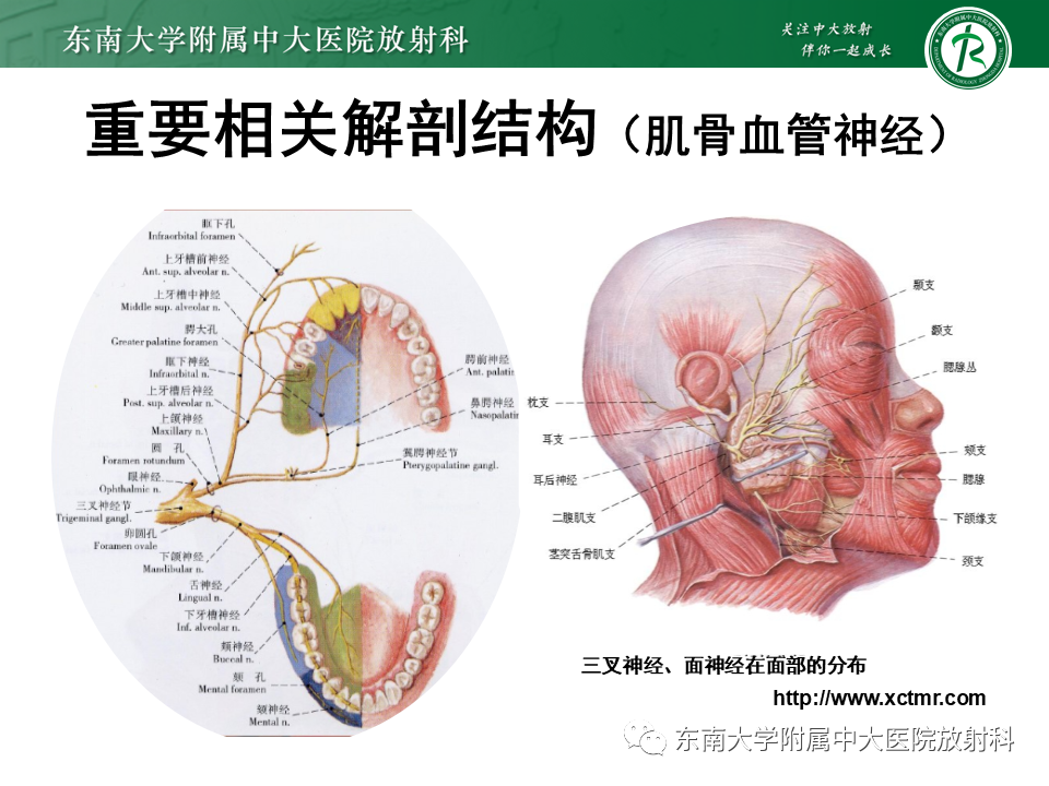 影像PPT - 【病例】颌面部恶性黑色素瘤1例MR影像-8