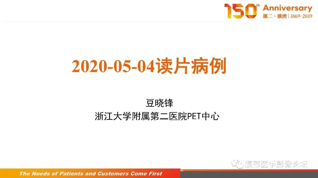 影像PPT - 【病例】胰腺、肝脏髓系肉瘤(绿色瘤)1例CT及MR影像-1 影像PPT - 【病例】胰腺、肝脏髓系肉瘤(绿色瘤)1例CT及MR影像-1