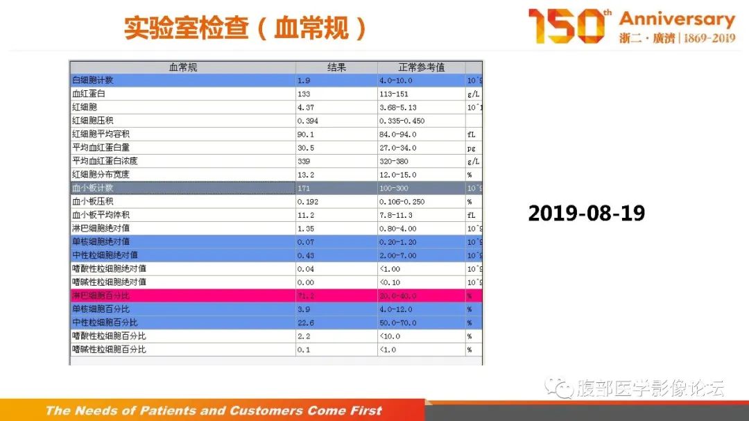 影像PPT - 【病例】胰腺、肝脏髓系肉瘤(绿色瘤)1例CT及MR影像-3 影像PPT - 【病例】胰腺、肝脏髓系肉瘤(绿色瘤)1例CT及MR影像-3