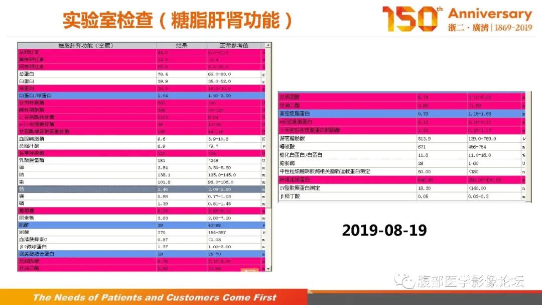 影像PPT - 【病例】胰腺、肝脏髓系肉瘤(绿色瘤)1例CT及MR影像-4 影像PPT - 【病例】胰腺、肝脏髓系肉瘤(绿色瘤)1例CT及MR影像-4