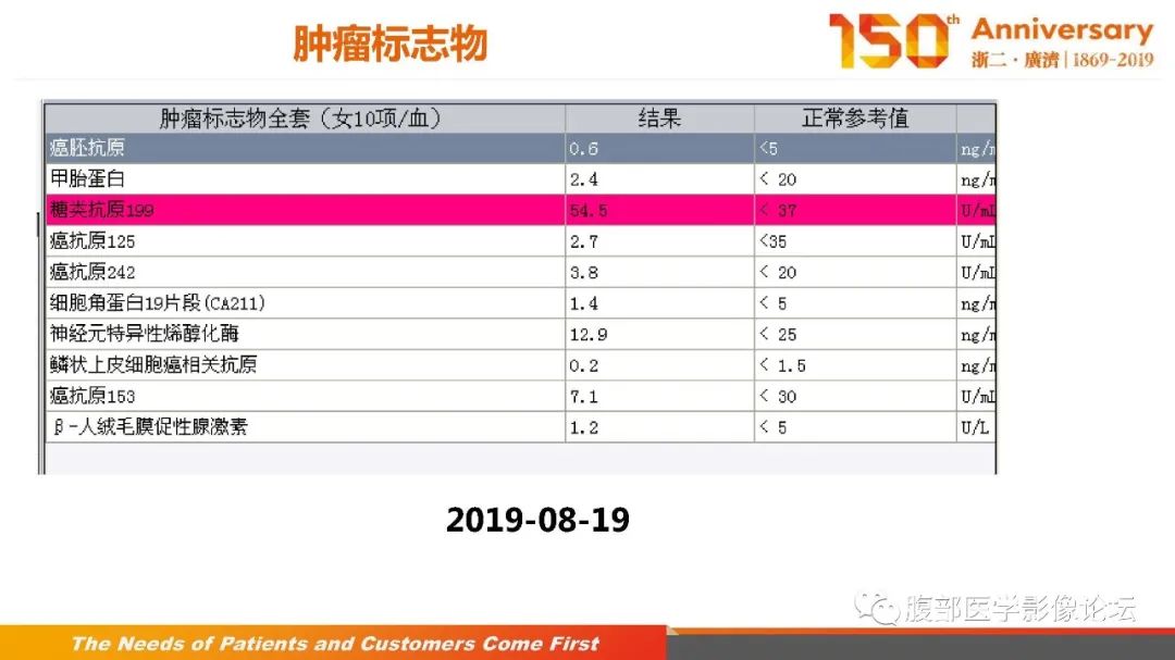 影像PPT - 【病例】胰腺、肝脏髓系肉瘤(绿色瘤)1例CT及MR影像-5 影像PPT - 【病例】胰腺、肝脏髓系肉瘤(绿色瘤)1例CT及MR影像-5