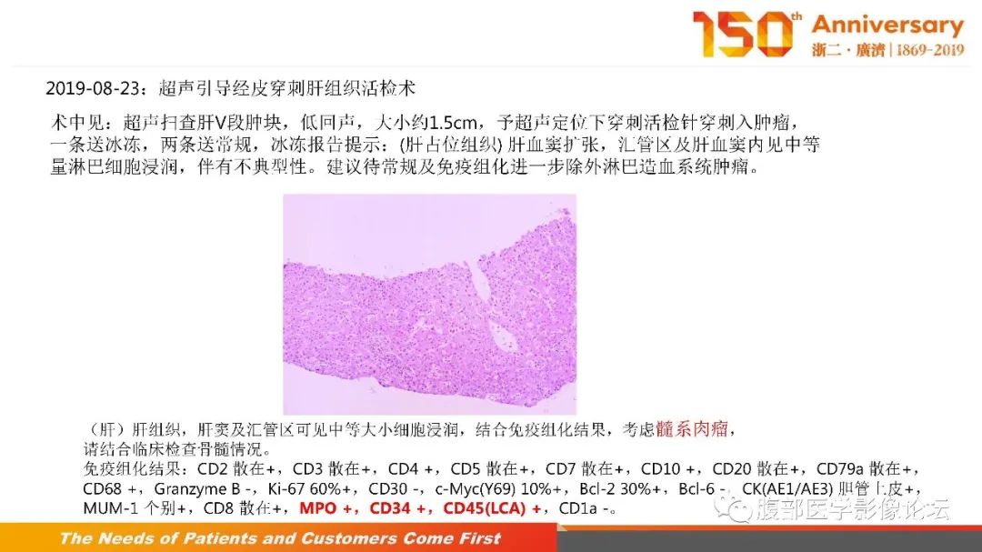 影像PPT - 【病例】胰腺、肝脏髓系肉瘤(绿色瘤)1例CT及MR影像-22 影像PPT - 【病例】胰腺、肝脏髓系肉瘤(绿色瘤)1例CT及MR影像-22