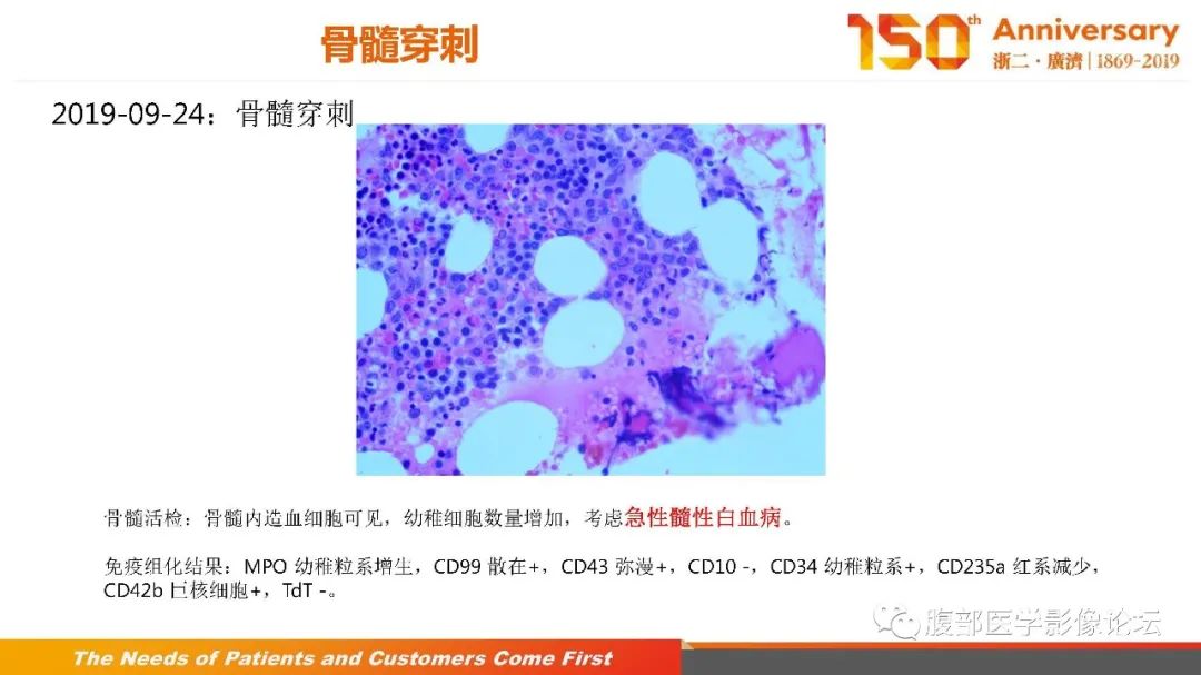 影像PPT - 【病例】胰腺、肝脏髓系肉瘤(绿色瘤)1例CT及MR影像-23 影像PPT - 【病例】胰腺、肝脏髓系肉瘤(绿色瘤)1例CT及MR影像-23
