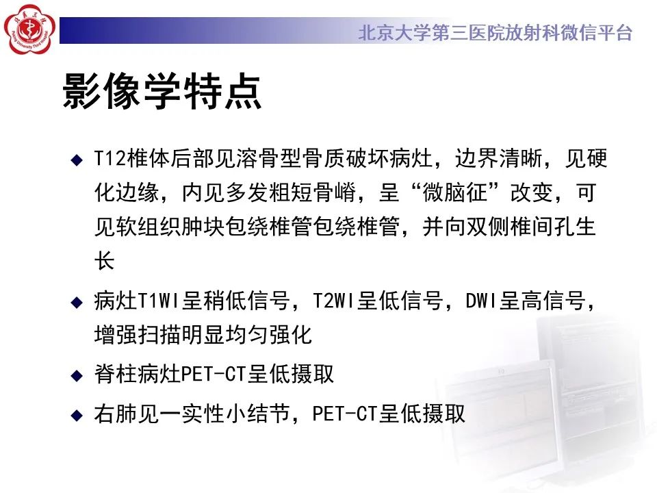 影像PPT - 【PPT】脊柱良性转移性平滑肌瘤-8