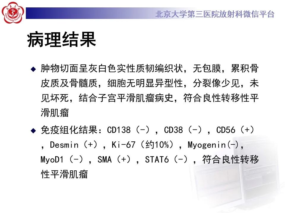 影像PPT - 【PPT】脊柱良性转移性平滑肌瘤-9