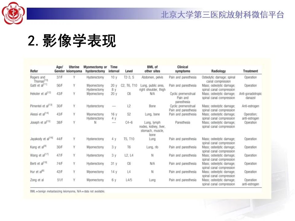 影像PPT - 【PPT】脊柱良性转移性平滑肌瘤-14