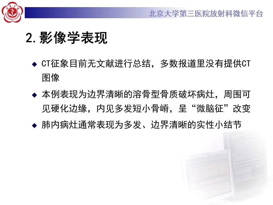 影像PPT - 【PPT】脊柱良性转移性平滑肌瘤-16
