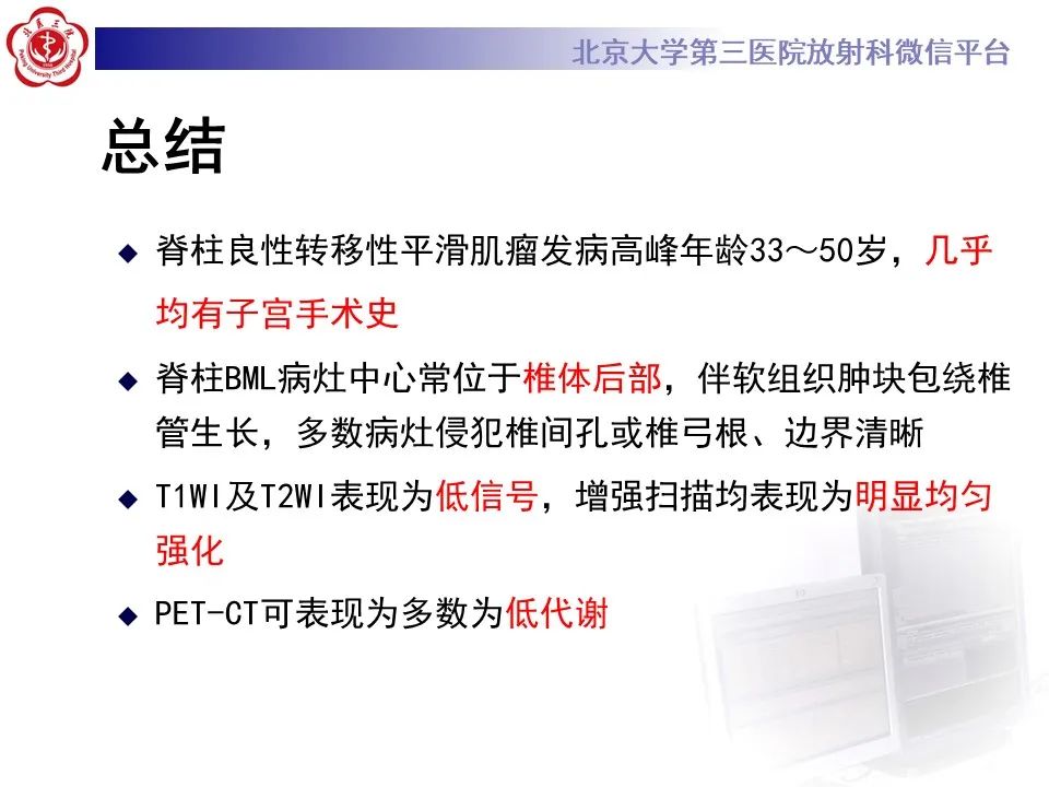 影像PPT - 【PPT】脊柱良性转移性平滑肌瘤-31
