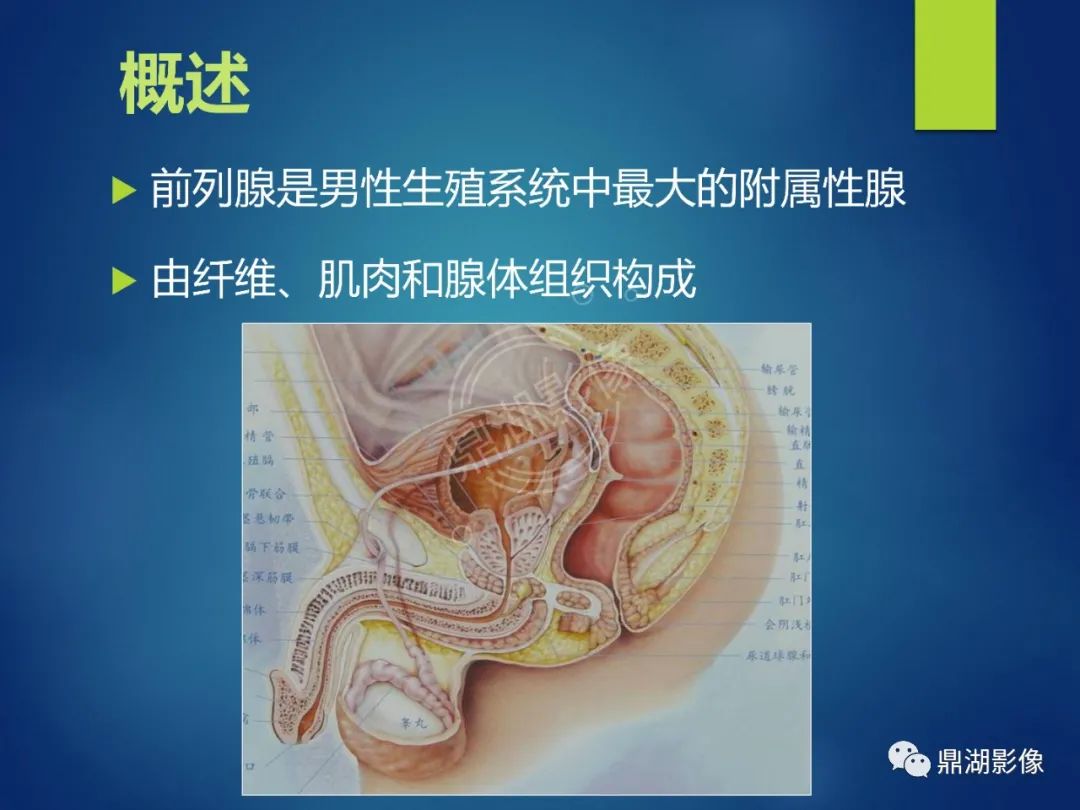 影像PPT - 【PPT】前列腺癌的磁共振成像诊断-2