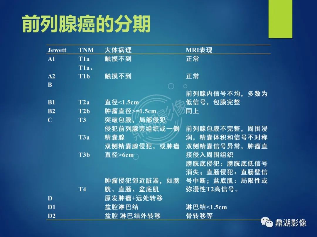 影像PPT - 【PPT】前列腺癌的磁共振成像诊断-15