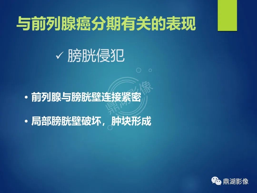 影像PPT - 【PPT】前列腺癌的磁共振成像诊断-35