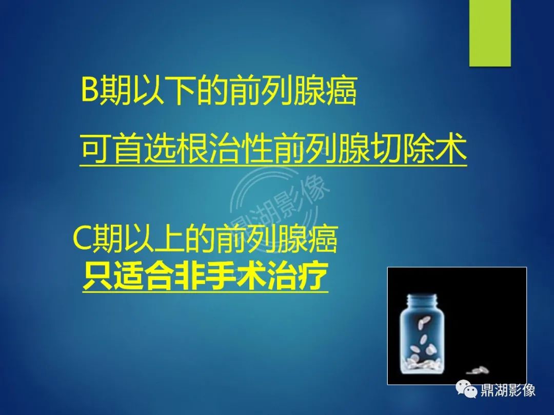 影像PPT - 【PPT】前列腺癌的磁共振成像诊断-43