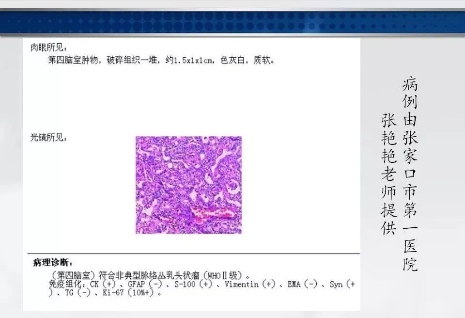 影像PPT - 【PPT】四脑室肿瘤影像诊断与鉴别诊断-21