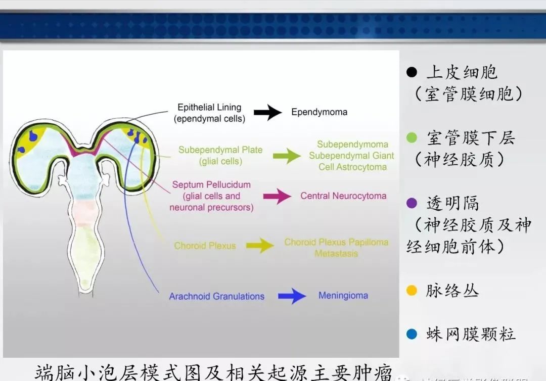 影像PPT - 【PPT】侧脑室肿瘤影像诊断及鉴别诊断-4