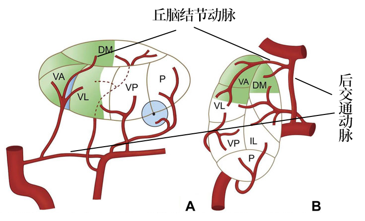 影像PPT - 【病例】双侧丘脑的同时梗死罕见,但是见过一次就不会忘了-3 影像PPT - 【病例】双侧丘脑的同时梗死罕见,但是见过一次就不会忘了-3