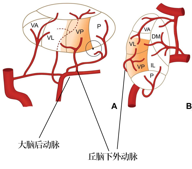 影像PPT - 【病例】双侧丘脑的同时梗死罕见,但是见过一次就不会忘了-4 影像PPT - 【病例】双侧丘脑的同时梗死罕见,但是见过一次就不会忘了-4
