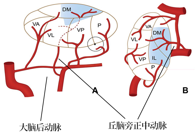 影像PPT - 【病例】双侧丘脑的同时梗死罕见,但是见过一次就不会忘了-6 影像PPT - 【病例】双侧丘脑的同时梗死罕见,但是见过一次就不会忘了-6