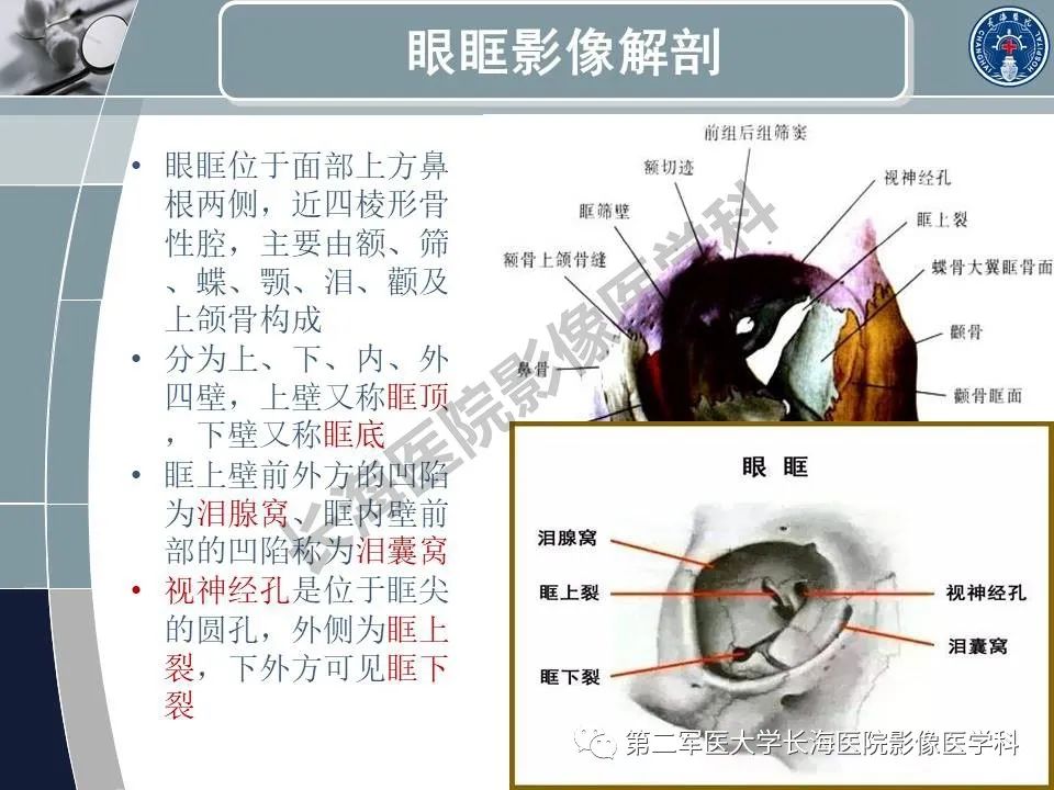 影像PPT - 【PPT】眼眶内肿瘤的影像诊断-3