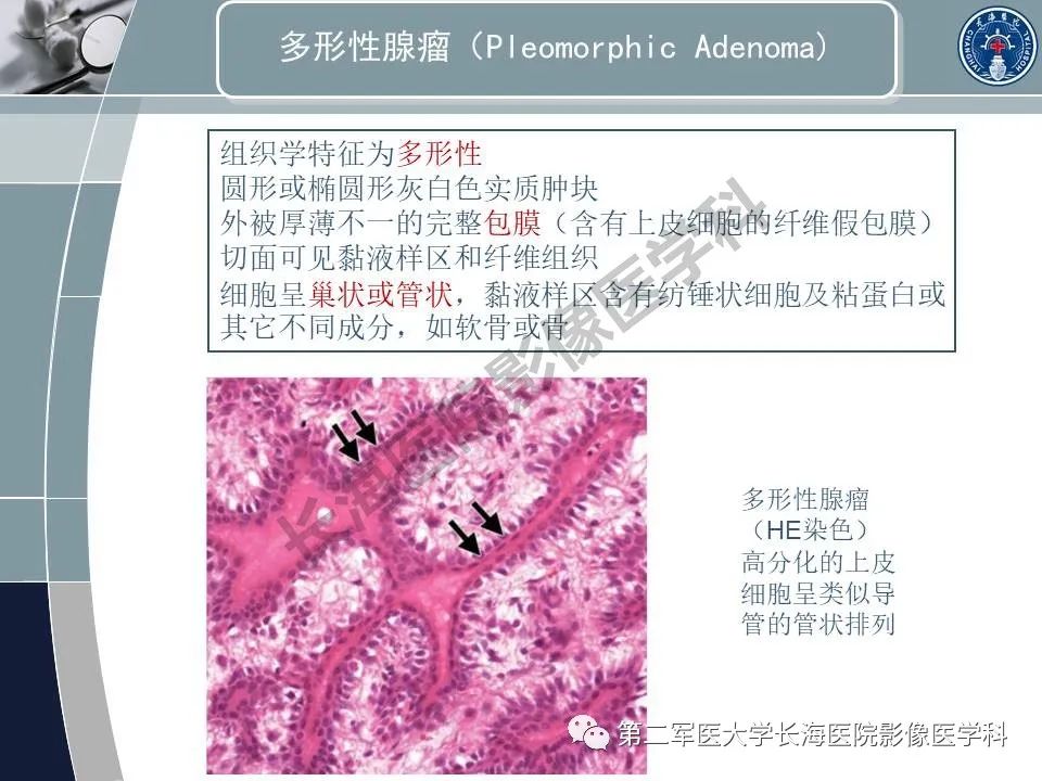 影像PPT - 【PPT】眼眶内肿瘤的影像诊断-55