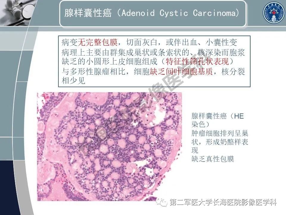 影像PPT - 【PPT】眼眶内肿瘤的影像诊断-60