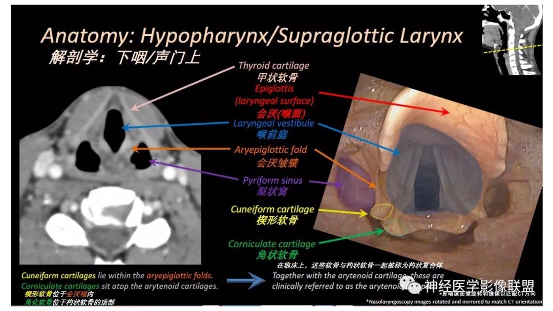 影像PPT - 【PPT】内窥镜对照的咽喉CT解剖学研究-15