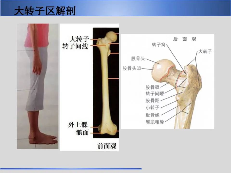 影像PPT - 【PPT】股骨大转子疼痛综合征MR特征-3