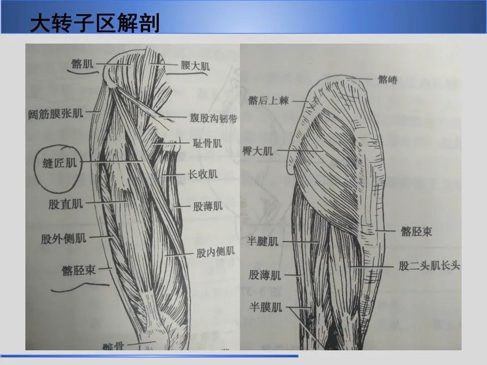 影像PPT - 【PPT】股骨大转子疼痛综合征MR特征-5