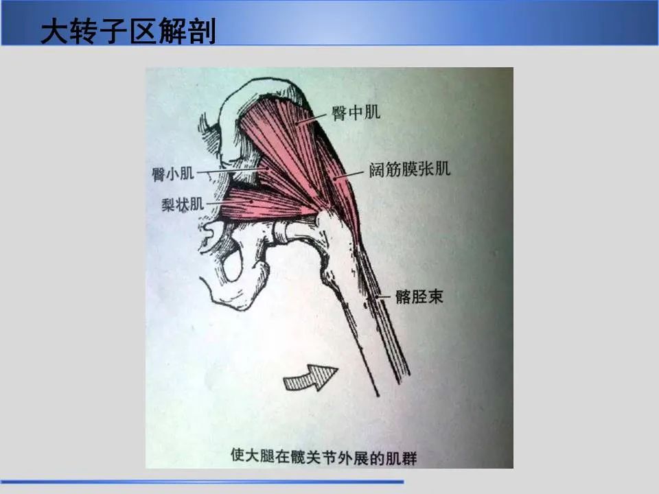 影像PPT - 【PPT】股骨大转子疼痛综合征MR特征-6