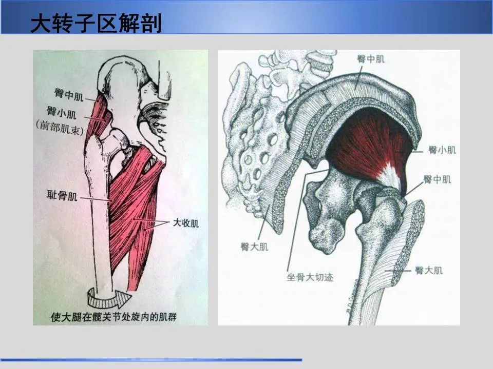 影像PPT - 【PPT】股骨大转子疼痛综合征MR特征-7