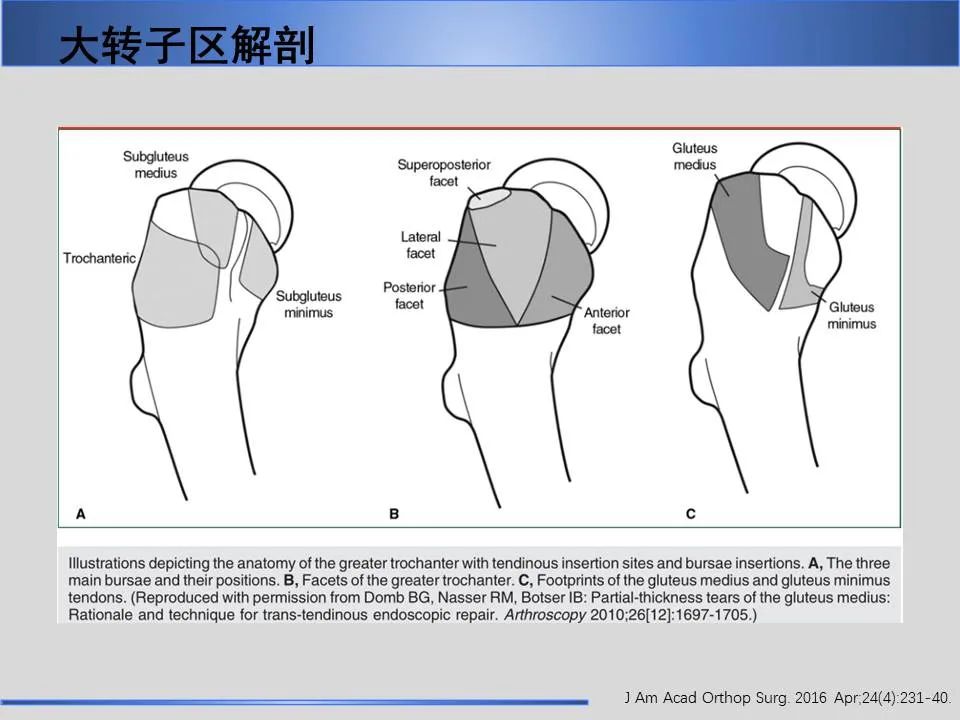 影像PPT - 【PPT】股骨大转子疼痛综合征MR特征-8