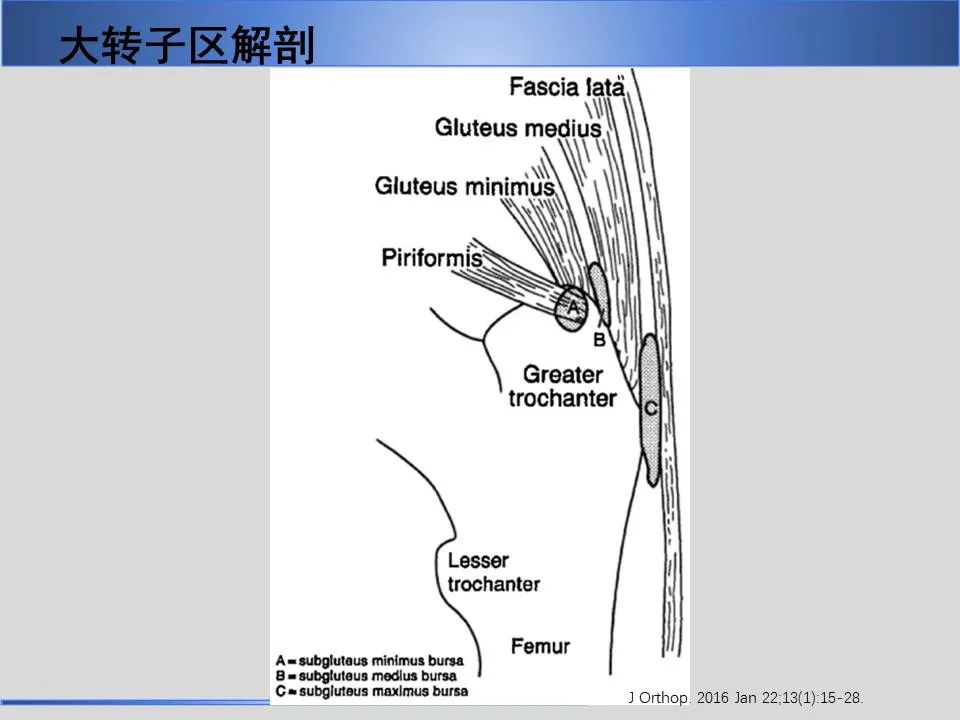 影像PPT - 【PPT】股骨大转子疼痛综合征MR特征-9