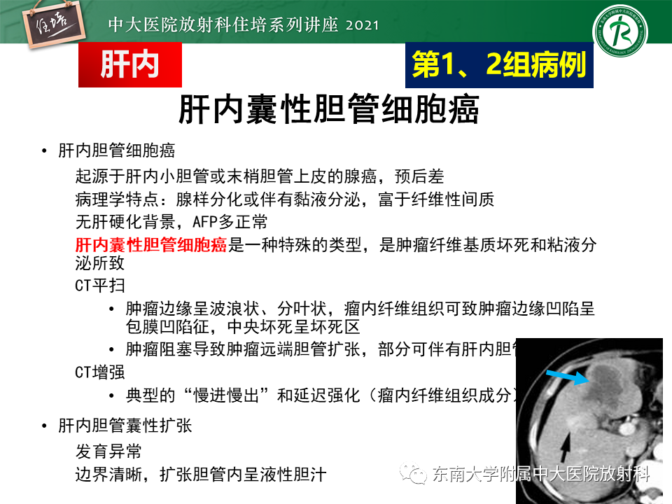 影像PPT - 【PPT】认识胆道系统影像常见漏诊、误诊病变-9