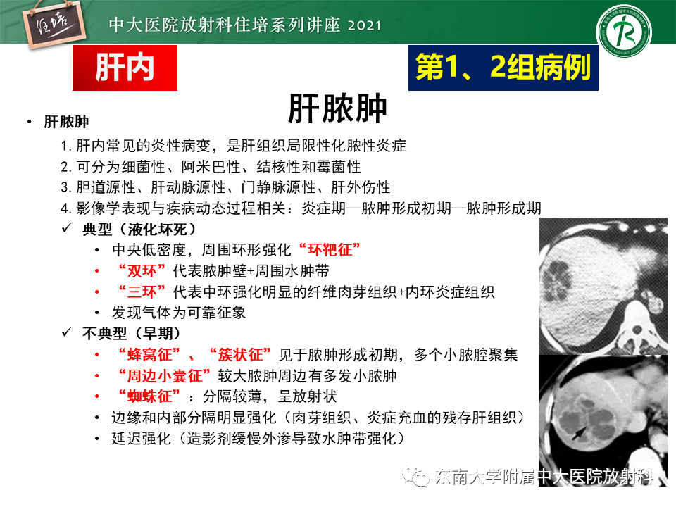 影像PPT - 【PPT】认识胆道系统影像常见漏诊、误诊病变-10
