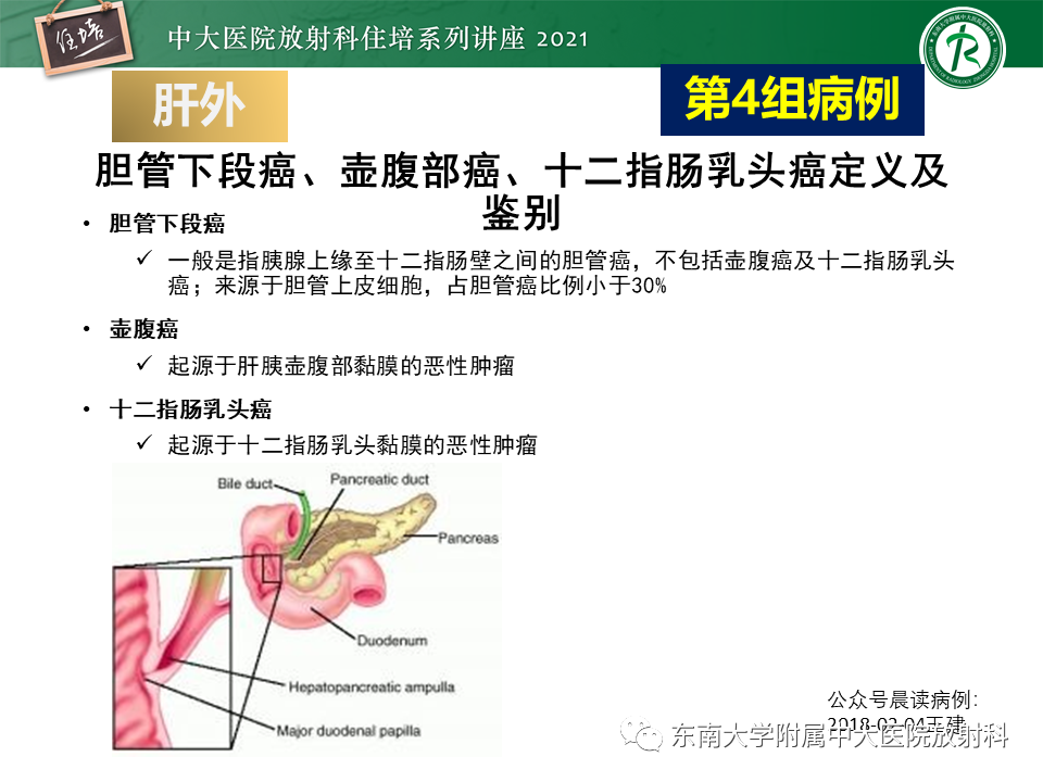 影像PPT - 【PPT】认识胆道系统影像常见漏诊、误诊病变-42