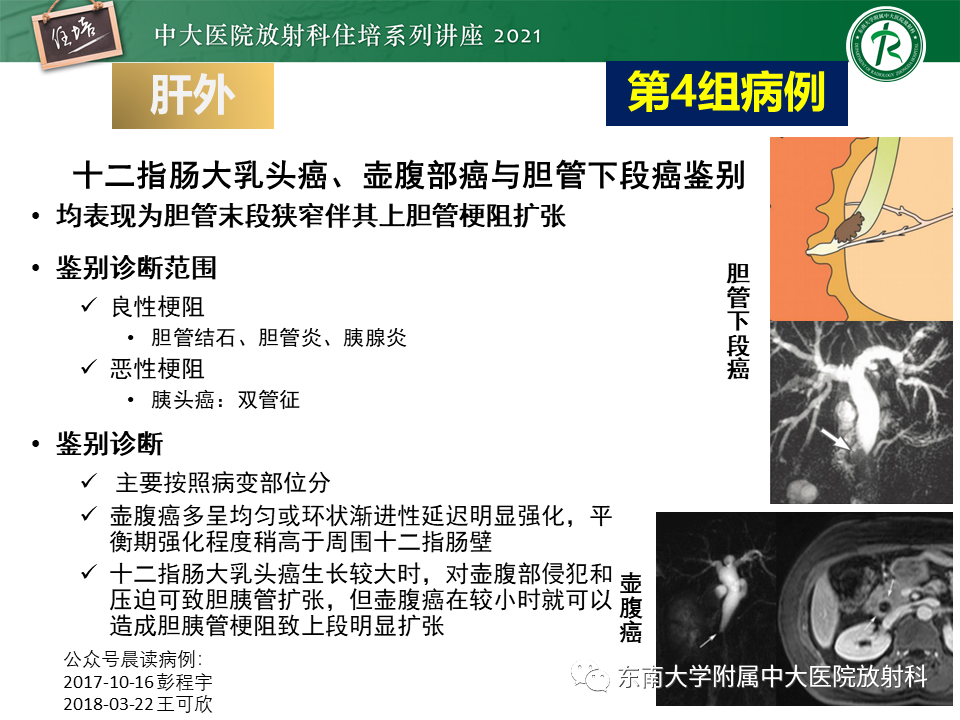 影像PPT - 【PPT】认识胆道系统影像常见漏诊、误诊病变-45