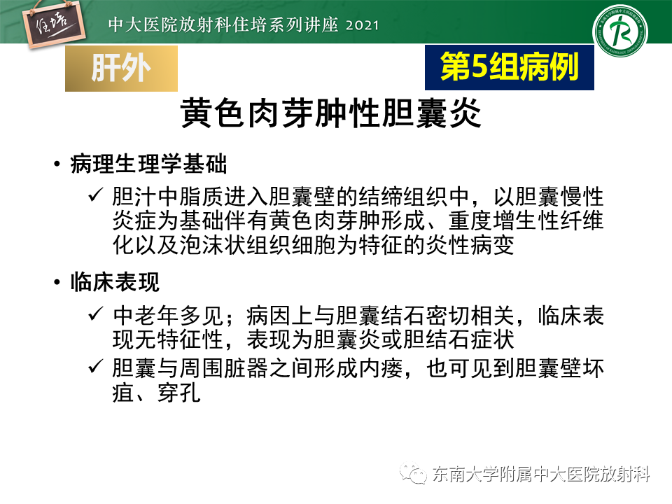 影像PPT - 【PPT】认识胆道系统影像常见漏诊、误诊病变-50