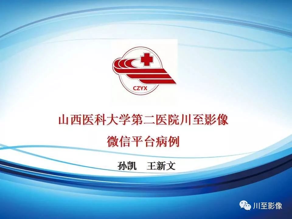 影像PPT - 【病例】上半规管裂综合征2例CT影像-1 影像PPT - 【病例】上半规管裂综合征2例CT影像-1