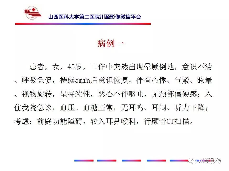影像PPT - 【病例】上半规管裂综合征2例CT影像-2 影像PPT - 【病例】上半规管裂综合征2例CT影像-2