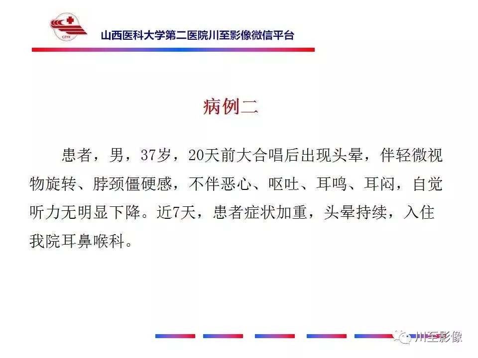 影像PPT - 【病例】上半规管裂综合征2例CT影像-7 影像PPT - 【病例】上半规管裂综合征2例CT影像-7
