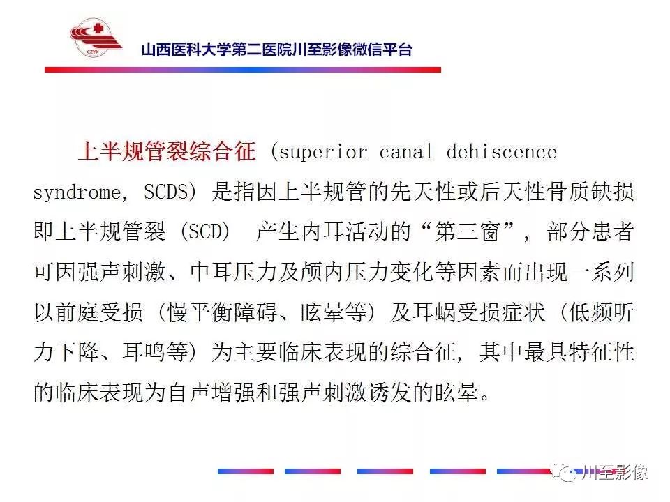 影像PPT - 【病例】上半规管裂综合征2例CT影像-12 影像PPT - 【病例】上半规管裂综合征2例CT影像-12
